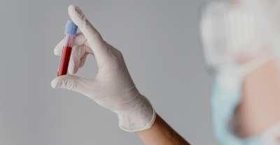 PatologÃ­a HemostÃ¡tica y trastornos de la coagulaciÃ...